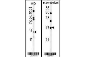 (LEFT)Western blot analysis of TPPP3 Antibody in WiDr cell tissue lysates (35ug/lane). (TPPP3 Antikörper  (C-Term))