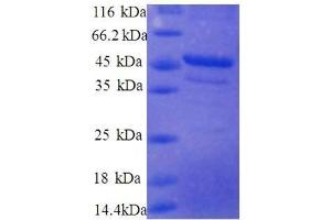 Ribosomal Protein S10 (RPS10) (AA 4-165), (partial) protein (GST tag)