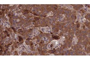 Immunohistochemistry (IHC) image for anti-Endothelin Receptor Type B (EDNRB) (C-Term) antibody (ABIN6266206)