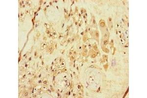 Immunohistochemistry of paraffin-embedded human placenta tissue using ABIN7167986 at dilution of 1:100 (ARHGEF5 Antikörper  (AA 433-507))