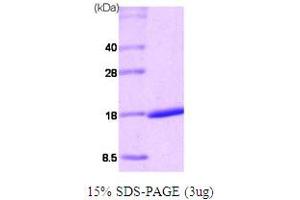 SDS-PAGE (SDS) image for Retinoic Acid Receptor, alpha (RARA) (AA 68-173) protein (His tag) (ABIN667055) (Retinoic Acid Receptor alpha Protein (AA 68-173) (His tag))