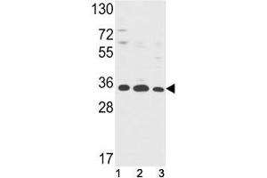 Western blot analysis of Annexin V antibody and (1) HepG2, (2) A2058, (3) T47D lysate. (Annexin V Antikörper  (AA 1-30))