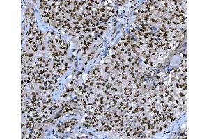 IHC analysis of UBC12/UBE2M using anti-UBC12/UBE2M antibody (ABIN7600885). (UBE2M Antikörper  (AA 25-154))