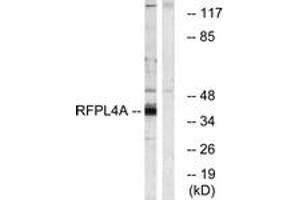 Western blot analysis of extracts from HuvEc cells, using RFPL4A Antibody.