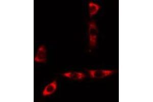 ABIN6277564 staining A549 cells by IF/ICC. (CYB5A Antikörper  (Internal Region))