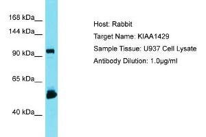 Host: Rabbit Target Name: KIAA1429 Sample Type: U937 Whole Cell lysates Antibody Dilution: 1. (VIRMA/KIAA1429 Antikörper  (C-Term))