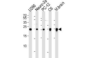 Western blot analysis of lysates from , mouse Neuro-2a, rat PC-12, C6 cell line and mouse brain tissue lysate(from left to right), using UCHL1 Antibody (ABIN1539817 and ABIN2843804). (UCHL1 Antikörper)
