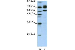 Western Blotting (WB) image for anti-Adenosine Deaminase, RNA-Specific, B1 (ADARB1) antibody (ABIN2462101)