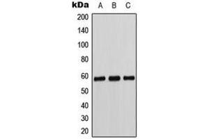 Western blot analysis of Cytochrome P450 11B1/2 expression in K562 (A), Caki1 (B), MCF7 (C) whole cell lysates. (Cytochrome P450 11B1/2 (N-Term) Antikörper)