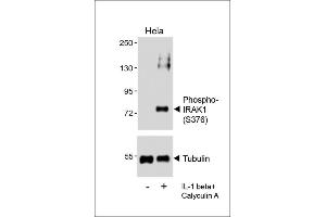 Western blot analysis of lysates from Hela cell line, untreated or treated with IL-1 beta(20 ng/mL) + Calyculin A(100nM), using (ABIN6241064 and ABIN6578961) (upper) or Tubulin (lower). (IRAK1 Antikörper  (pSer376))