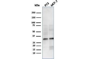 Western Blot Analysis of PC3 and MCF-7 cell lysate using NKX2. (Rekombinanter NKX2-8 Antikörper  (AA 10-123))