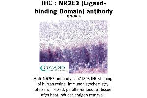 Image no. 1 for anti-Nuclear Receptor Subfamily 2, Group E, Member 3 (NR2E3) antibody (ABIN1737507) (NR2E3 Antikörper)