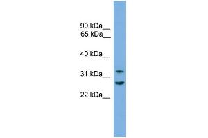 WB Suggested Anti-FSTL1 Antibody Titration: 0.
