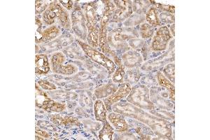 Immunohistochemistry of paraffin-embedded mouse kidney using Sterol carrier protein 2 Rabbit mAb (ABIN7270597) at dilution of 1:100 (40x lens). (SCP2 Antikörper)