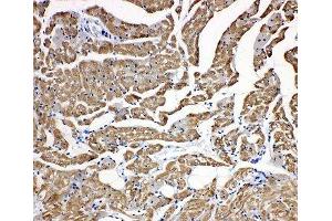IHC-P: Troponin C antibody testing of rat heart tissue