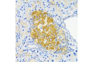 Immunohistochemistry of paraffin-embedded rat islets of langerhans using CCND1 antibody.