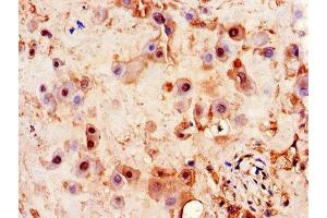 Immunohistochemistry of paraffin-embedded human placenta tissue using ABIN7163469 at dilution of 1:100 (PITX3 Antikörper  (AA 10-200))