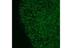 Immunofluorescence analysis of human iPS cells using NANOG antibody (green). (Nanog Antikörper  (AA 20-166))