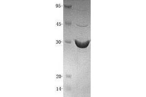 Validation with Western Blot (TOLLIP Protein (His tag))