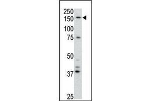 Image no. 1 for anti-ATP-Binding Cassette, Sub-Family B (MDR/TAP), Member 4 (ABCB4) (Center) antibody (ABIN358591) (ABCB4 Antikörper  (Center))