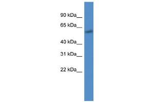 WB Suggested Anti-CYP7B1 AntibodyTitration: 1. (CYP7B1 Antikörper  (C-Term))