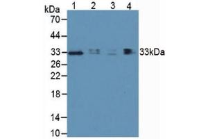 Western blot analysis of (1) Human Lung Tissue, (2) Human Hepg2 Cells, (3) Human 293T Cells and (4) Porcine Lymph Node Tissue. (TIM3 Antikörper  (AA 22-202))