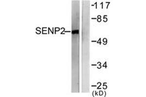 Western Blotting (WB) image for anti-SUMO1/sentrin/SMT3 Specific Peptidase 2 (SENP2) (AA 481-530) antibody (ABIN2889276) (SENP2 Antikörper  (AA 481-530))