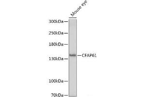 Western blot analysis of extracts of Mouse eye using CFAP61 Polyclonal Antibody at dilution of 1:1000. (CFAP61 Antikörper)