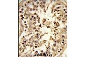Immunohistochemistry (Paraffin-embedded Sections) (IHC (p)) image for anti-CDC42 Effector Protein (Rho GTPase Binding) 3 (CDC42EP3) (AA 1-30), (N-Term) antibody (ABIN652721)