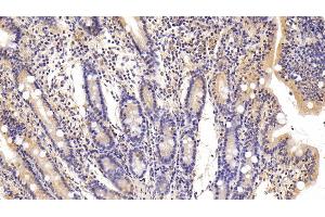 Detection of FAS in Porcine Small intestine Tissue using Polyclonal Antibody to Factor Related Apoptosis (FAS) (FAS Antikörper)