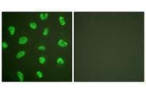 Immunofluorescence analysis of HeLa cells, treated with Forskolin (40nM, 30 mins), using DNA-PK antibody. (PRKDC Antikörper)