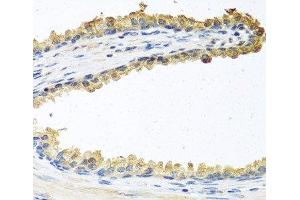 Immunohistochemistry of paraffin-embedded Human prostate using COCH Polyclonal Antibody at dilution of 1:100 (40x lens). (COCH Antikörper)