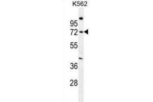 Western Blotting (WB) image for anti-Sphingomyelin phosphodiesterase 1, Acid Lysosomal (SMPD1) antibody (ABIN2996601) (SMPD1 Antikörper)