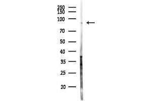 anti-Ecotropic Viral Integration Site 5 (EVI5) antibody