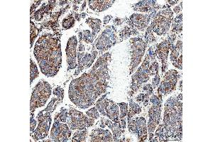 IHC analysis of MUT using anti-MUT antibody (ABIN4886676).