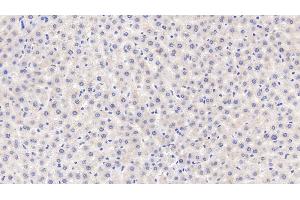 Detection of MT1 in Rat Liver Tissue using Polyclonal Antibody to Metallothionein 1 (MT1)