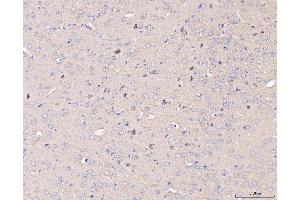 IHC analysis of MT-CO2 using anti-MT-CO2 antibody (ABIN7599081). (COX2 Antikörper  (AA 1-205))