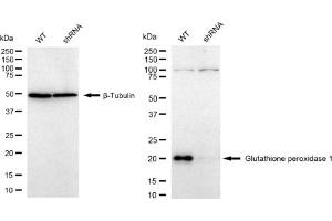Western blotting analysis using Glutathione peroxidase 1 antibody (ABIN7798752). (Rekombinanter Glutathione Peroxidase 1 Antikörper)