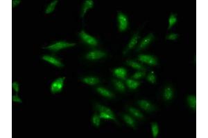 Immunofluorescence staining of Hela cells with ABIN7164337 at 1:100, counter-stained with DAPI. (DDX17 Antikörper  (AA 591-692))