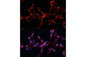 Immunofluorescence analysis of NIH/3T3 cells using Cathepsin L/V/K/H antibody (ABIN6127670, ABIN6139235, ABIN6139237 and ABIN6215636) at dilution of 1:100. (Cathepsin L Antikörper  (AA 114-333))