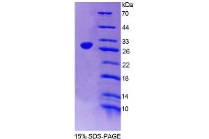 SDS-PAGE analysis of Mouse DKC Protein. (DKC1 Protein)