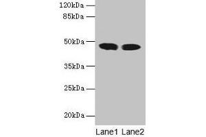 Western blot All lanes: ACADL antibody at 8 μg/mL Lane 1: Mouse kidney tissue Lane 2: Mouse heart tissue Secondary Goat polyclonal to rabbit IgG at 1/10000 dilution Predicted band size: 48 kDa Observed band size: 48 kDa (ACADL Antikörper  (AA 30-260))