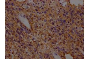 Immunohistochemistry (IHC) image for anti-Solute Carrier Family 1 (Glial High Affinity Glutamate Transporter), Member 3 (SLC1A3) (AA 146-236) antibody (ABIN7152226)