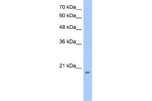 WB Suggested Anti-MGC4172 Antibody Titration:  0. (MGC4172 (C-Term) Antikörper)