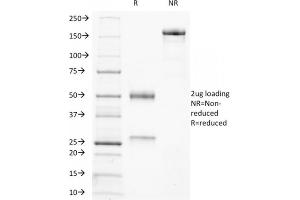 SDS-PAGE Analysis Purified Ku Mouse Monoclonal Antibody (KU729). (XRCC6/XRCC5 Antikörper)