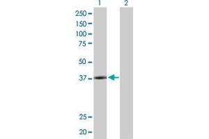 Western Blot analysis of PLA2G15 expression in transfected 293T cell line by PLA2G15 MaxPab polyclonal antibody. (PLA2G15 Antikörper  (AA 1-412))