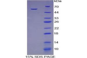 SDS-PAGE analysis of Pig Cathepsin K Protein.