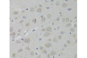 Immunohistochemistry of paraffin-embedded Rat brain using HSD17B13 Polyclonal Antibody at dilution of 1:100 (40x lens). (HSD17B13 Antikörper)