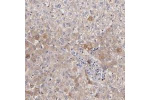 Immunohistochemical staining of human liver with FGB polyclonal antibody  shows moderate cytoplasmic positivity in hepatocytes. (Fibrinogen beta Chain Antikörper)
