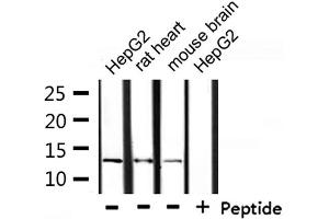 Western blot analysis of extracts from HepG2, rat heart and mouse brain, using NDUFA4L2 Antibody.